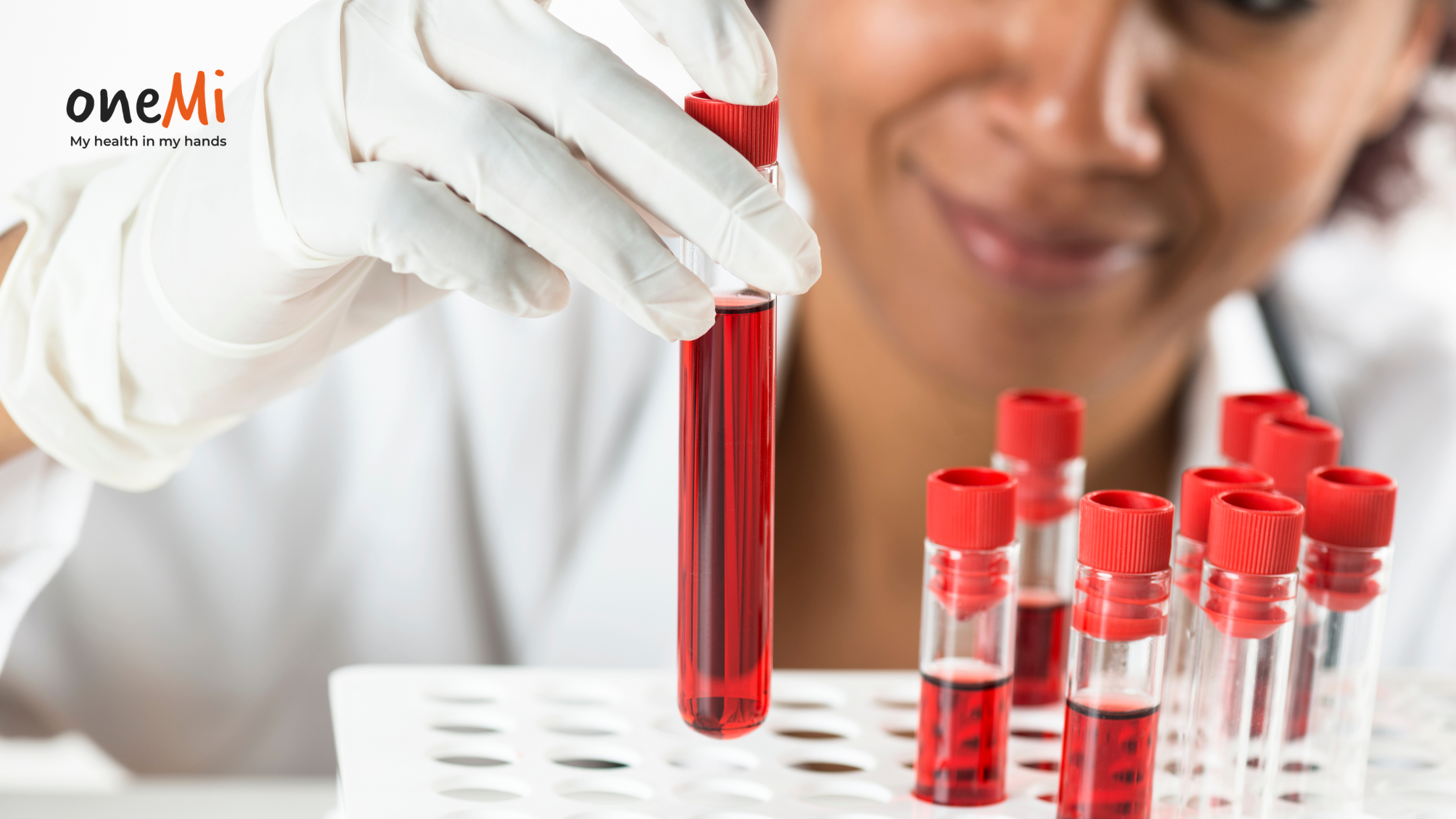 Understanding Your Blood Test: Beginner’s Guide to Reading Reports Easily – OneMi